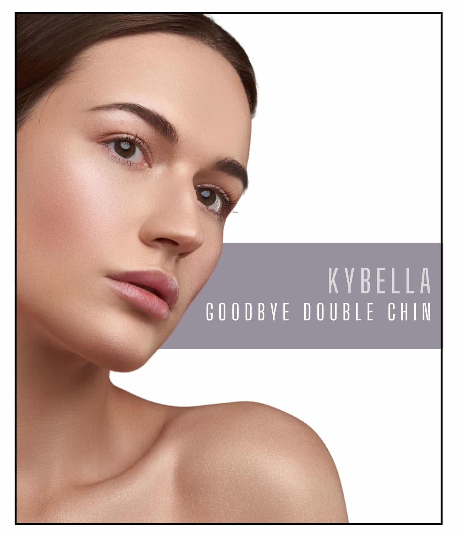 Woman with a defined chin after Kybella treatment.