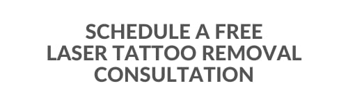 Schedule a free laser tattoo removal consultation.