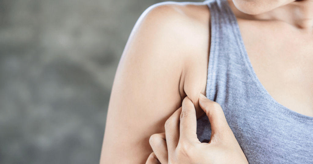 CoolSculpting for Armpit Fat Removal Without Surgery